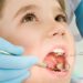 শিশুর দাঁতের ক্ষয়