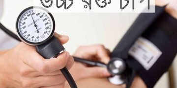 হাই প্রেসার বা হাইপারটেনশন (Hypertension) নিয়ে কিছু সচরাচর প্রশ্ন এবং তার উত্তর