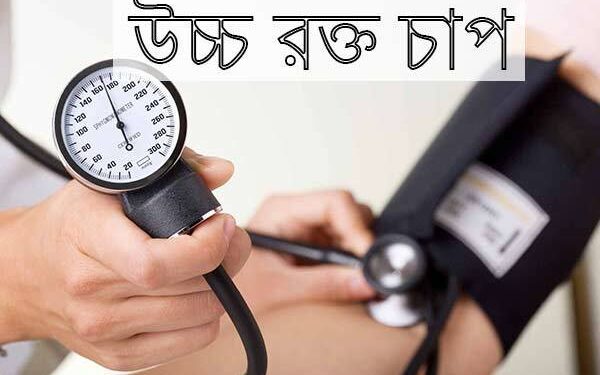 হাই প্রেসার বা হাইপারটেনশন (Hypertension) নিয়ে কিছু সচরাচর প্রশ্ন এবং তার উত্তর