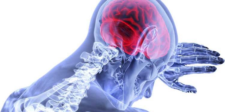 স্ট্রোকের ঝুঁকিতে প্রতি ৪ জনে একজন: স্ট্রোক দিবসে বক্তারা