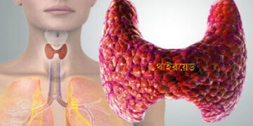 কম বয়সেই থাইরয়েডের সমস্যা কমাতে যা খাবেন-