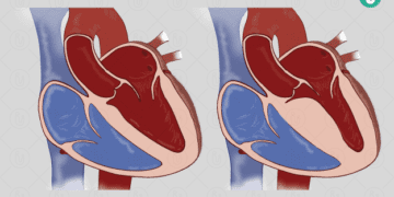 মাতৃত্বকালীন কার্ডিওমায়োপ্যাথি