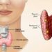 বিশ্রামেও ক্লান্তি হওয়া কি হতে পারে থাইরয়েড সমস্যা ?