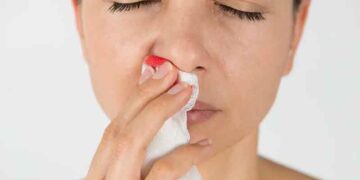 হঠাৎ নাক দিয়ে রক্ত ঝরলে করণীয়