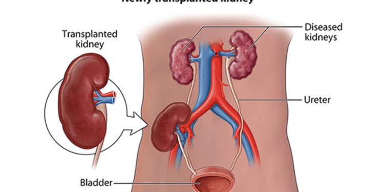 সোয়াপ ট্রান্সপ্ল্যান্ট’ চালুর কথা ভাবছে সরকার 